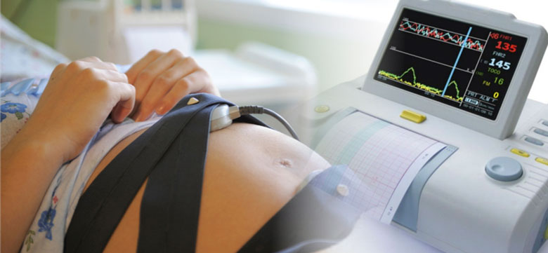 кардиотокография при беременности