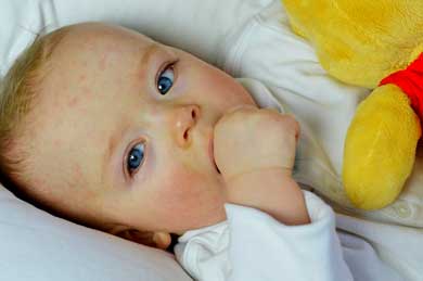 лечение кожных заболеваний у детей в перми