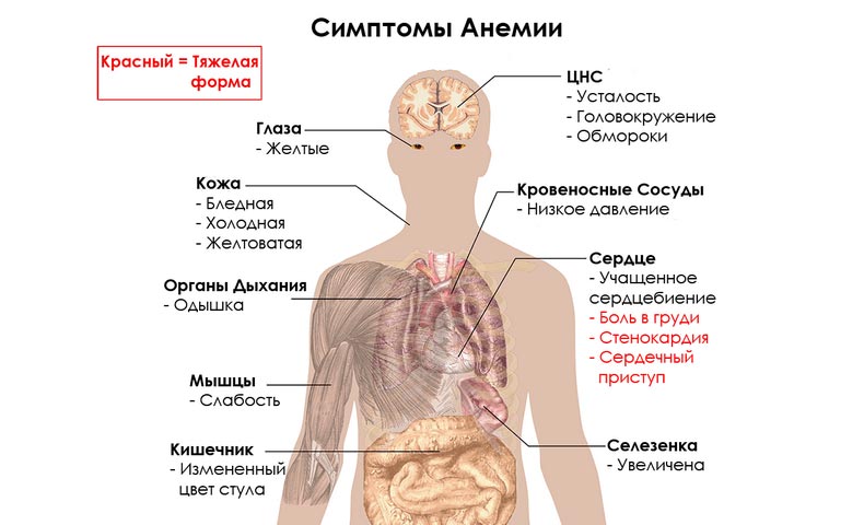 признаки анемии крови